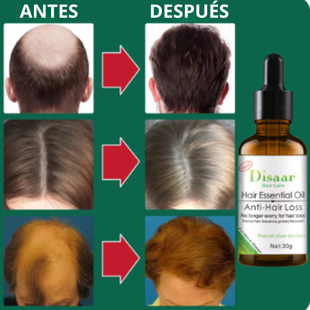 Capilux™ - Disaar Anti Caida Cabello