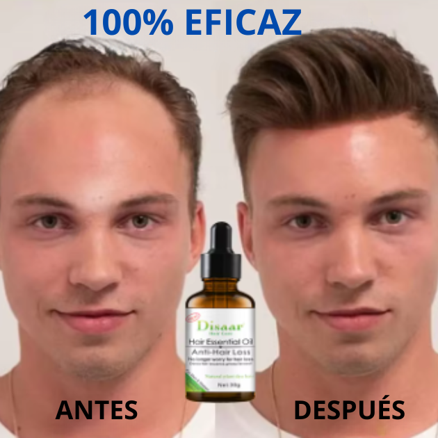 Capilux™ - Disaar Anti Caida Cabello